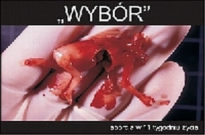 Kontrowersyjna Kampania 